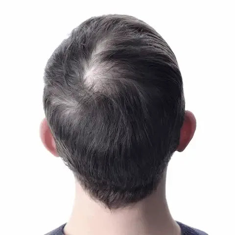 Hairzen Hair Root Activator Shampoo ™