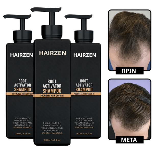 Hairzen Shampoing Hair Root Activator ™