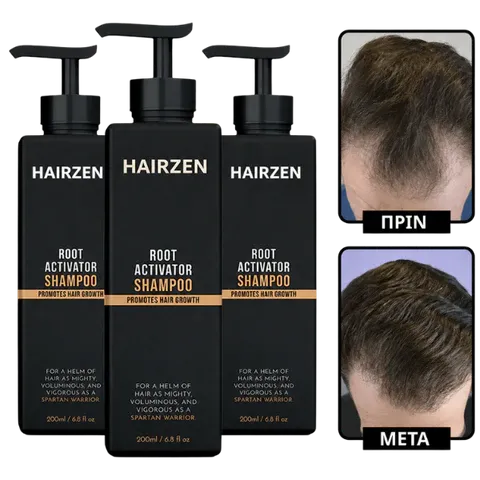 Hairzen Hair Root Activator Shampoo ™