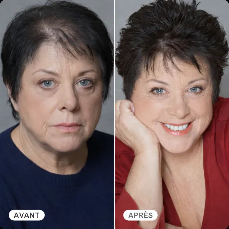 Hairzen Après-Shampooing de Croissance Capillaire ™
