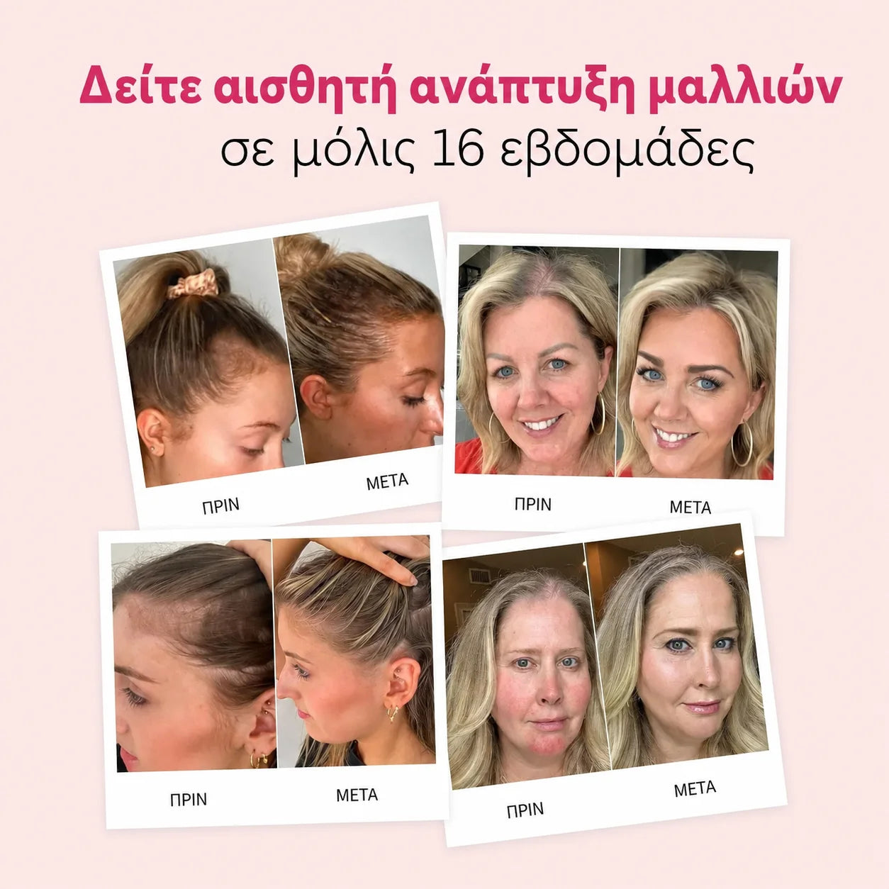 Το Shampoo Ανάπτυξης Μαλλιών Hairzen ™