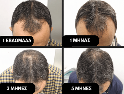 Hairzen Shampoing Hair Root Activator ™