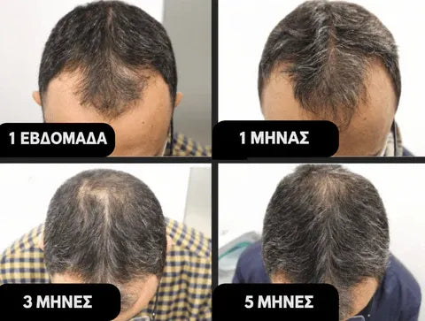 Hairzen Hair Root Activator Shampoo ™