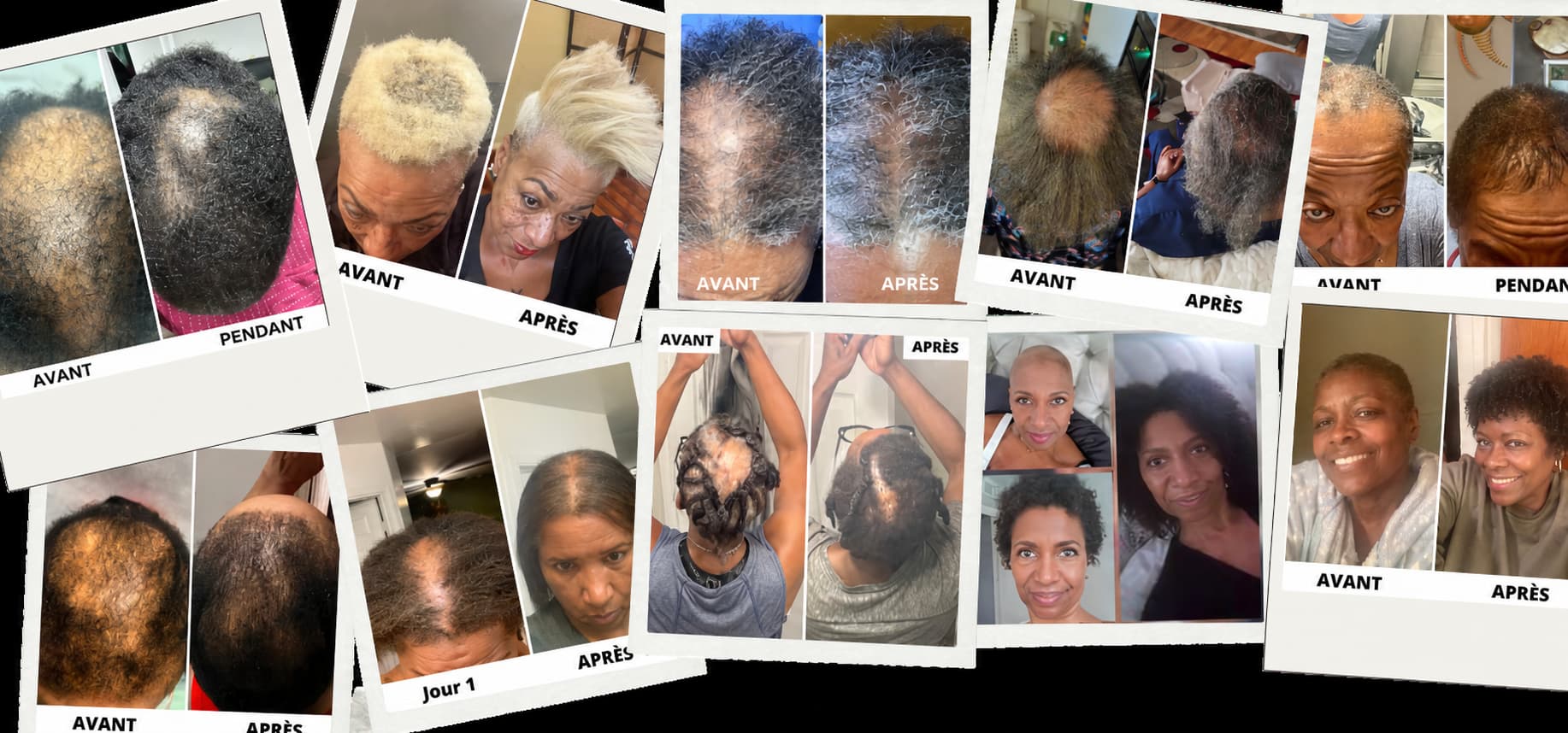 Sérum de Croissance Capillaire Hairzen ™