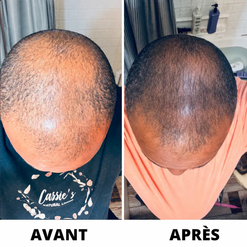 Sérum de Croissance Capillaire Hairzen ™