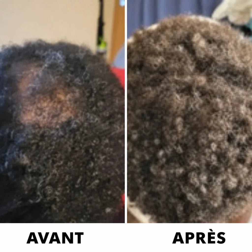 Sérum de Croissance Capillaire Hairzen ™